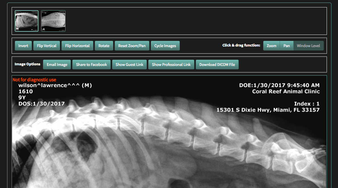 Dristech / Fovea DR